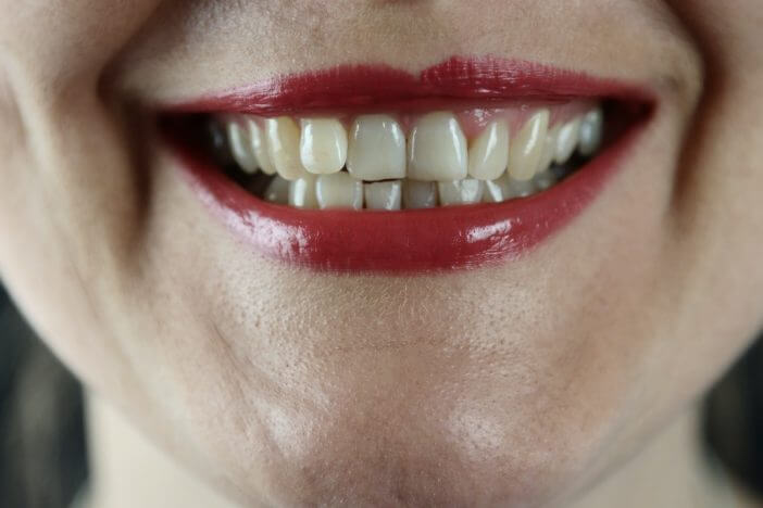 生体認証システムは「歯」の時代へ　インドで反響を呼ぶ『歯認証』って？