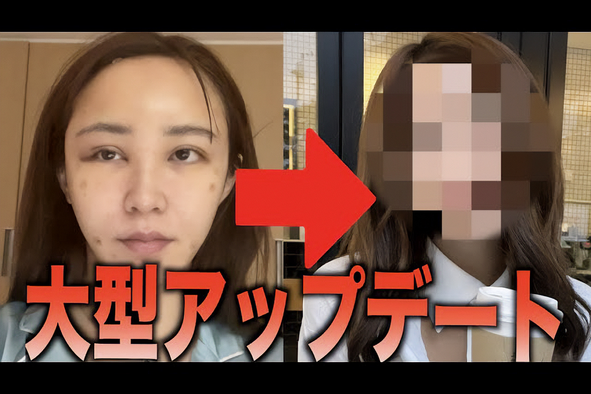 てんちむ、YouTubeで整形を報告の画像