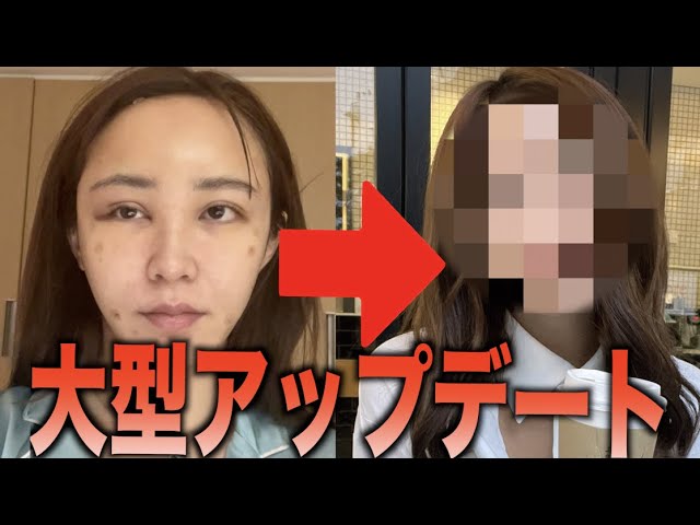 てんちむ、YouTubeで整形を報告の画像