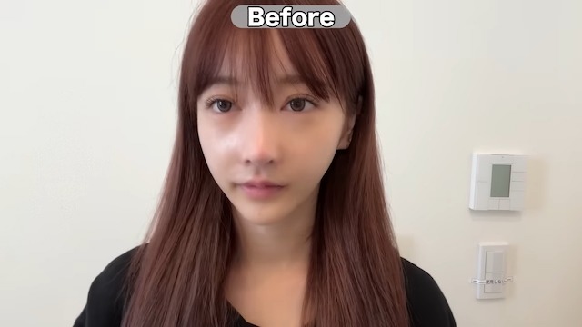 Rちゃん、総額30万円の整形手術を赤裸々公開の画像