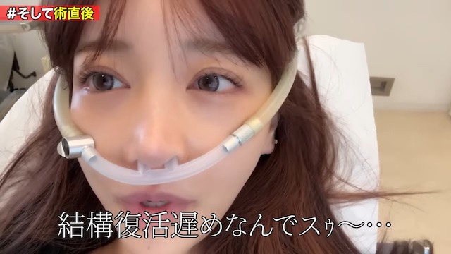 Rちゃん、総額30万円の整形手術を赤裸々公開の画像