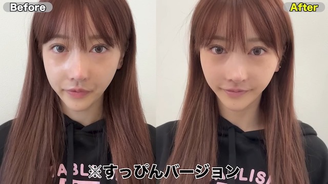 Rちゃん、総額30万円の整形手術を赤裸々公開の画像