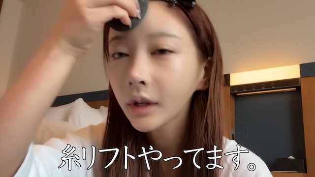 Rちゃん、総額30万円の整形手術を赤裸々公開の画像