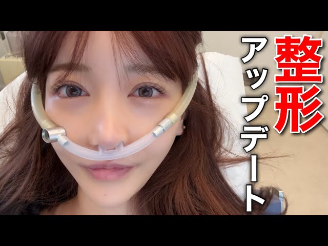 Rちゃん、整形の様子を赤裸々に公開　自然な仕上がりに周囲からは「痩せた？」