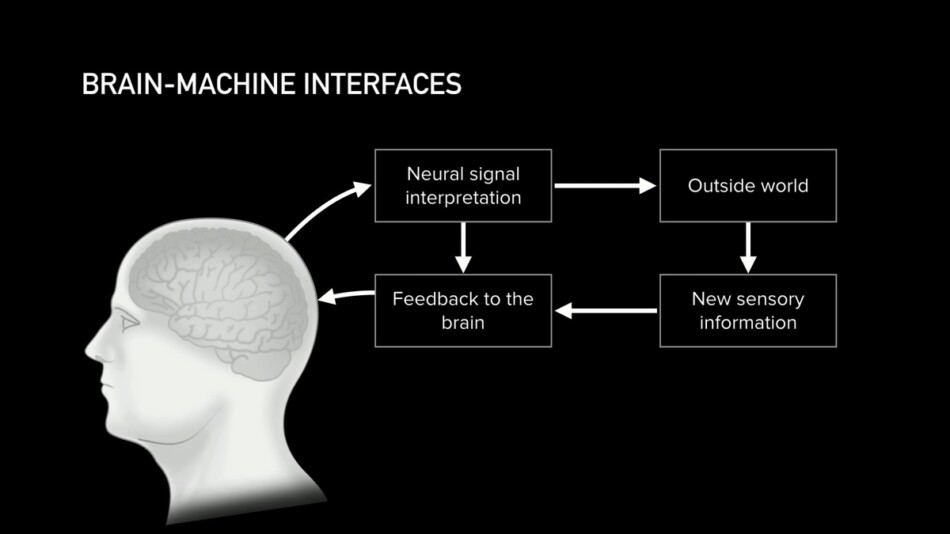 世界初、Neuralink患者の動画が公開