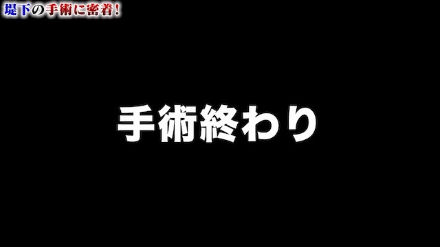 インパルス堤下、顔に皮下腫瘍の画像