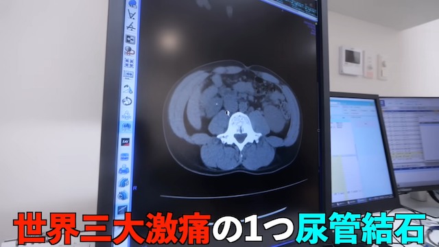 タケヤキ翔、人間ドックで“D判定”の画像