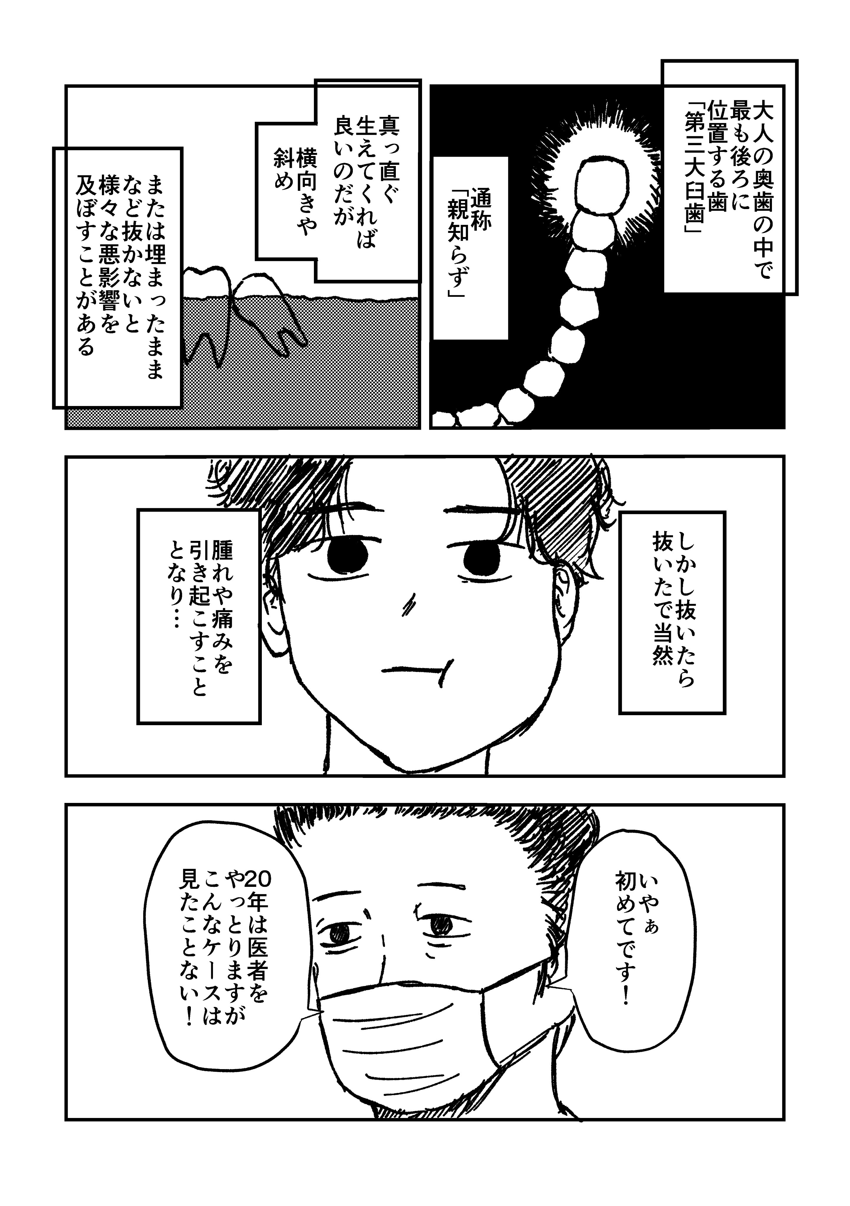 【漫画】抜歯で腫れた頬が形造ったのは…… の画像