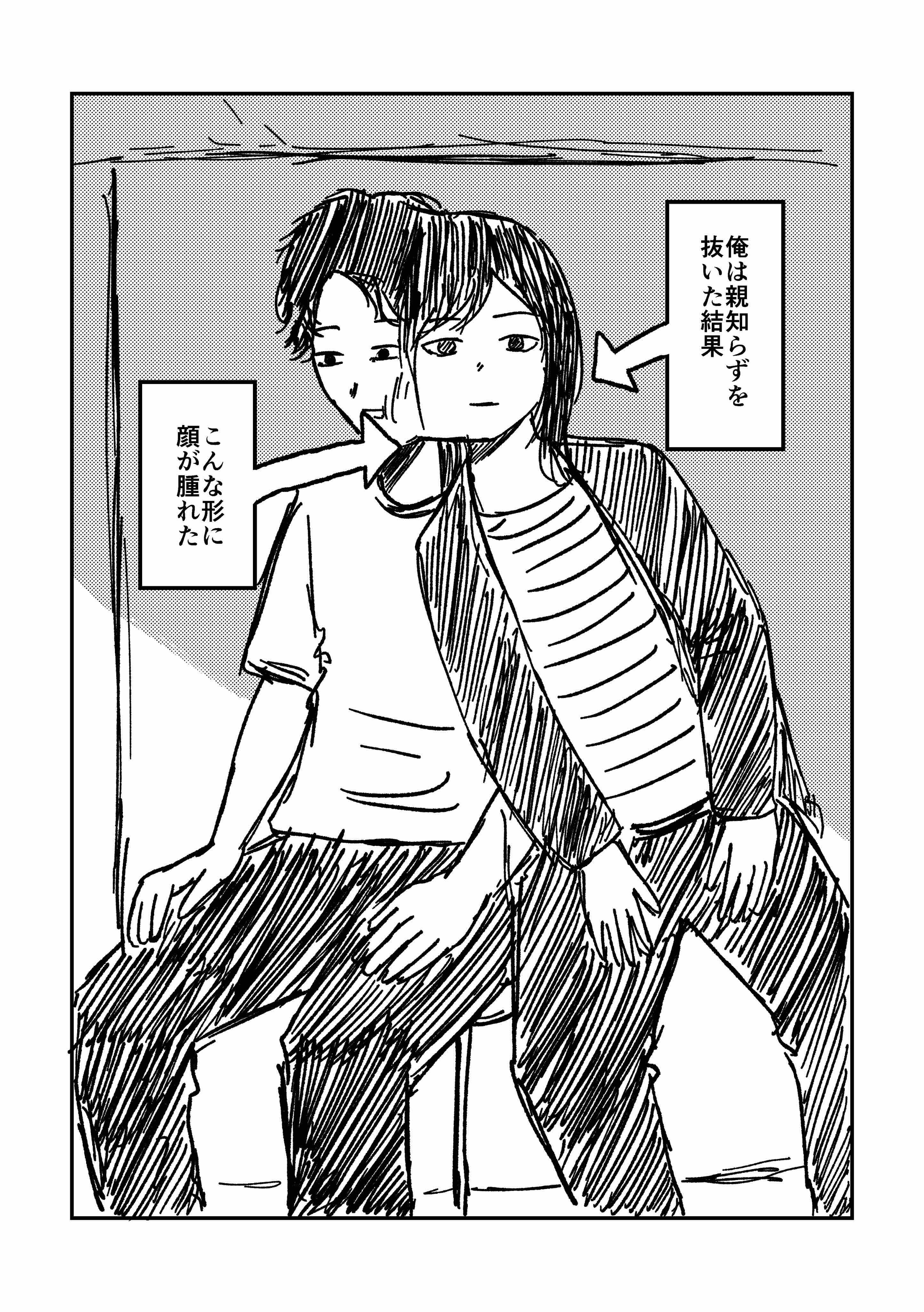 【漫画】抜歯で腫れた頬が形造ったのは…… の画像