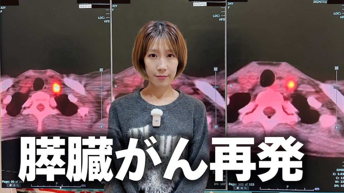 サニージャーニー、膵臓がんの再発を報告