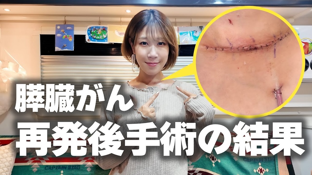 サニージャーニー、膵臓がん再発後の手術を報告