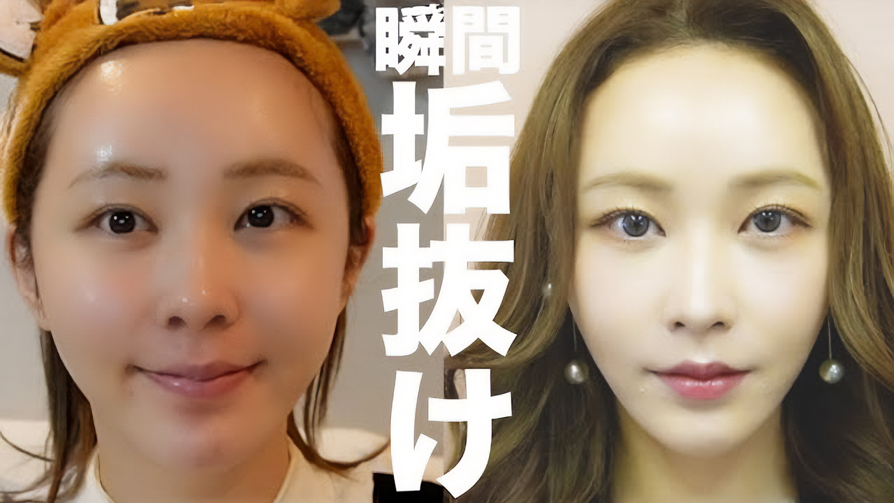 てんちむ、整形を告白の画像