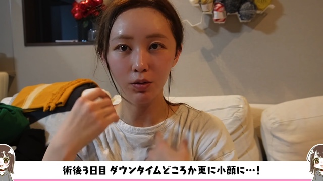 てんちむ、整形を告白の画像