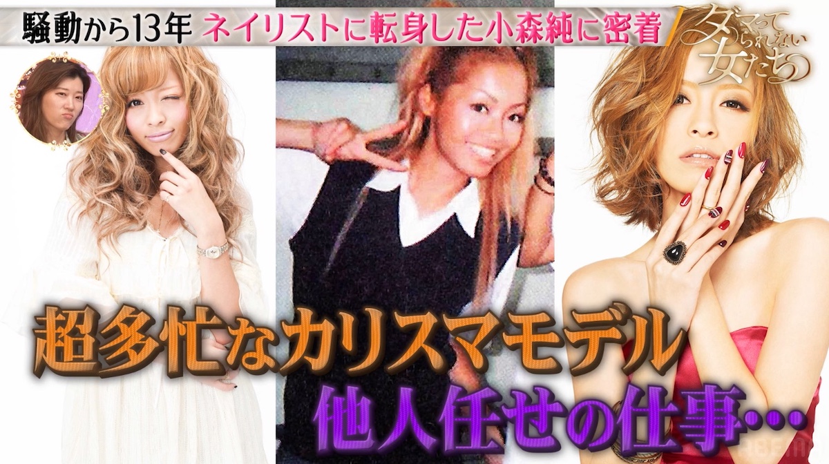 小森純が“ペニオク騒動”を振り返るの画像