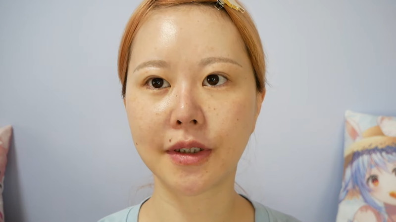 轟ちゃん、鼻の美容整形を明かすの画像