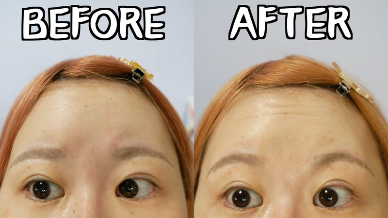 轟ちゃん、鼻の美容整形を明かすの画像