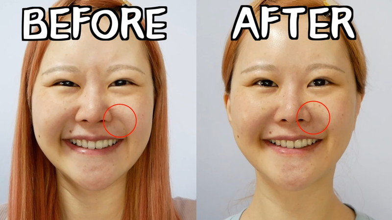 轟ちゃん、鼻の美容整形を明かすの画像