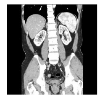 『トリセツ・カラダ　カラダ地図を描こう』の画像