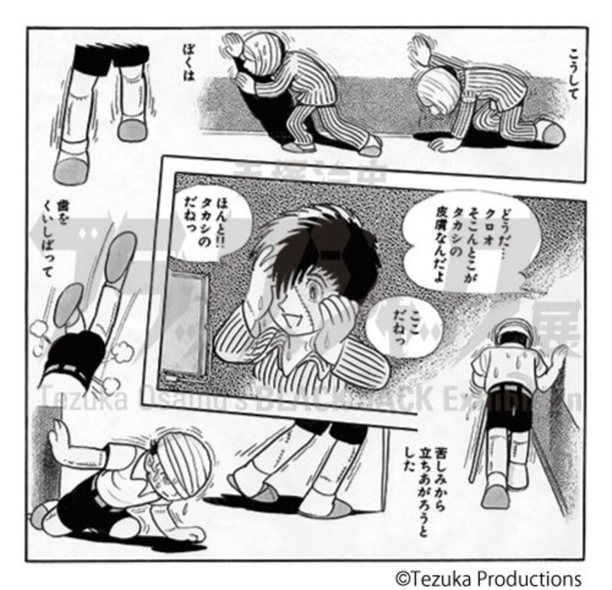 「手塚治虫 ブラック・ジャック展」開催の画像