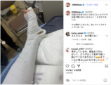 Takaの骨折に宇多田、野田ら反応の画像