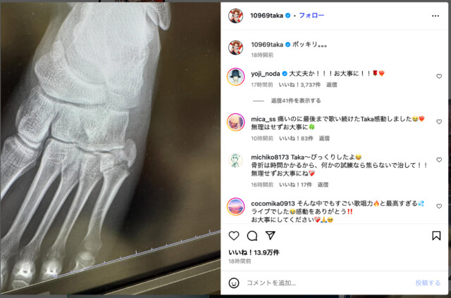 Takaの骨折に宇多田、野田ら反応の画像