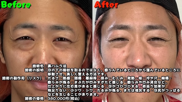 クマ取りをした東海オンエア・てつやの様子