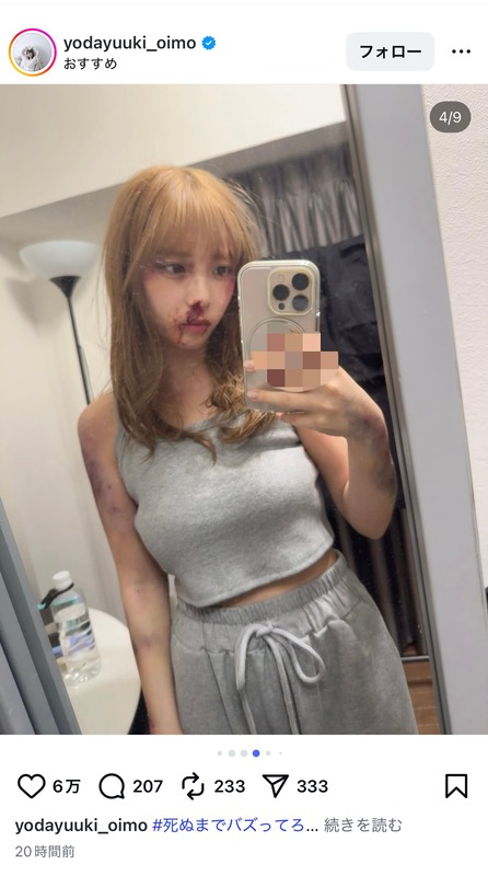 与田祐希、鼻血セルフィーなどを多数投稿の画像