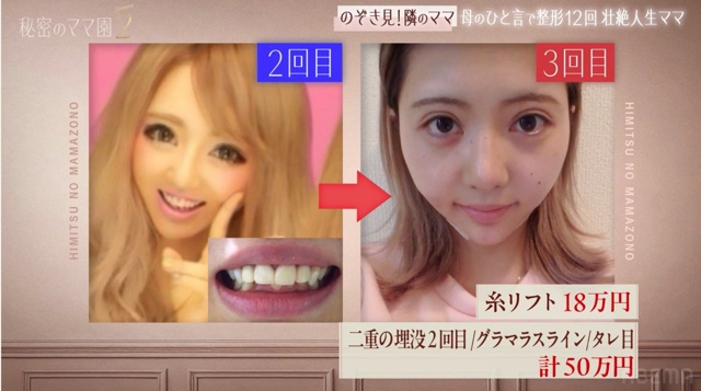 『秘密のママ園シーズン2』6話