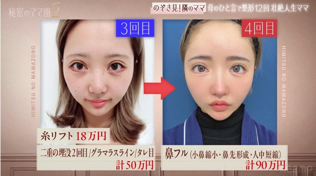 『秘密のママ園シーズン2』6話