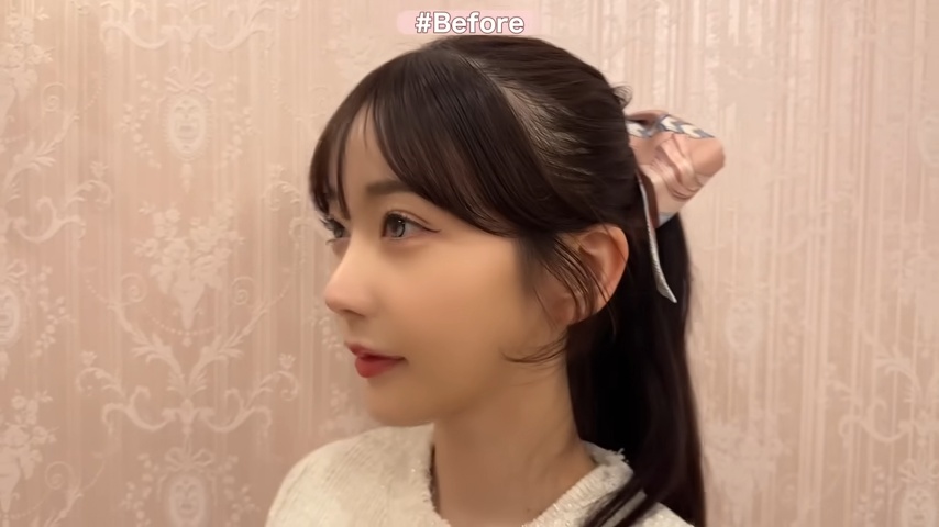 Rちゃん、“整形アプデ”でさらなる高みへ？の画像