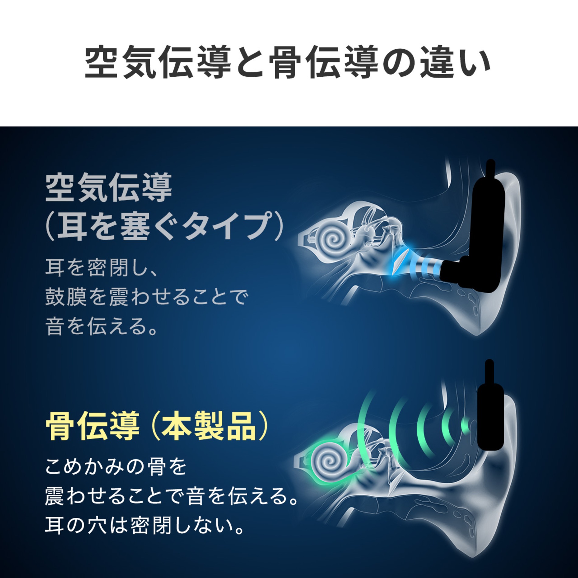 サンワの骨伝導集音器に新色ベージュ登場の画像