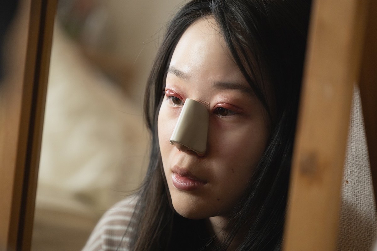 『ダウンタイム』人はなぜ美容外科を選ぶ？の画像