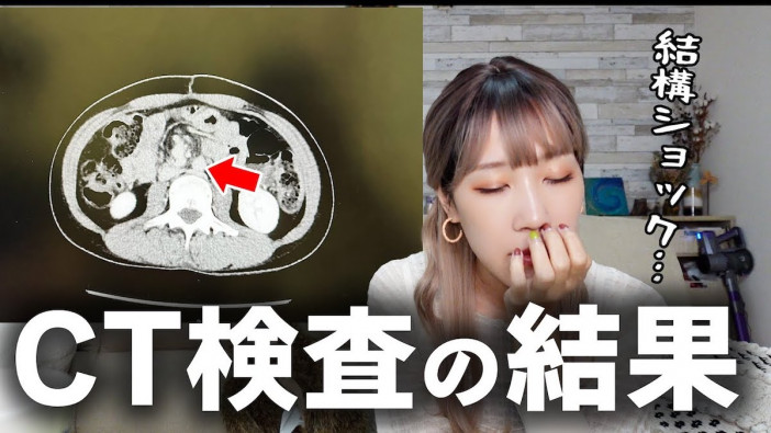 サニージャーニー・みずき、膵臓がん“再発の兆候”を報告 「みんな祈ってます」心配な表情にファンも応援