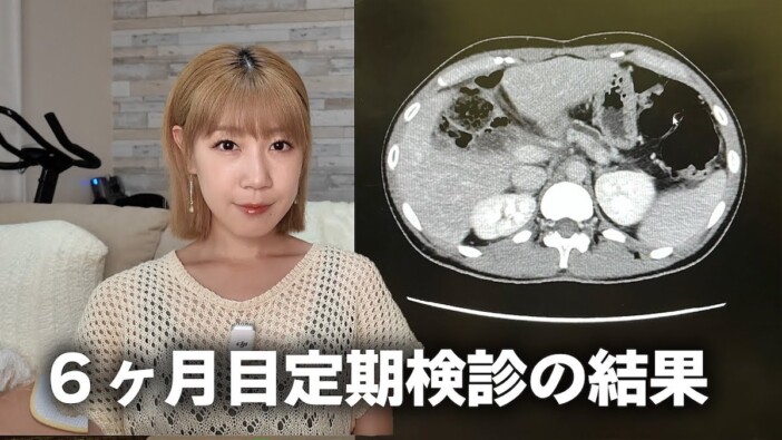 サニージャーニー、抗がん剤終了後の定期検診結果を報告 以前は「再発リスク高い」発言も